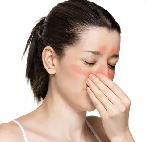 A close-up of a woman pinching her nose, eyes closed, with redness across her cheeks and forehead.