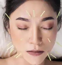A woman resting with her eyes closed during facial acupuncture.