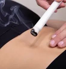A lit moxa stick held above the lower abdomen, with smoke rising during treatment.