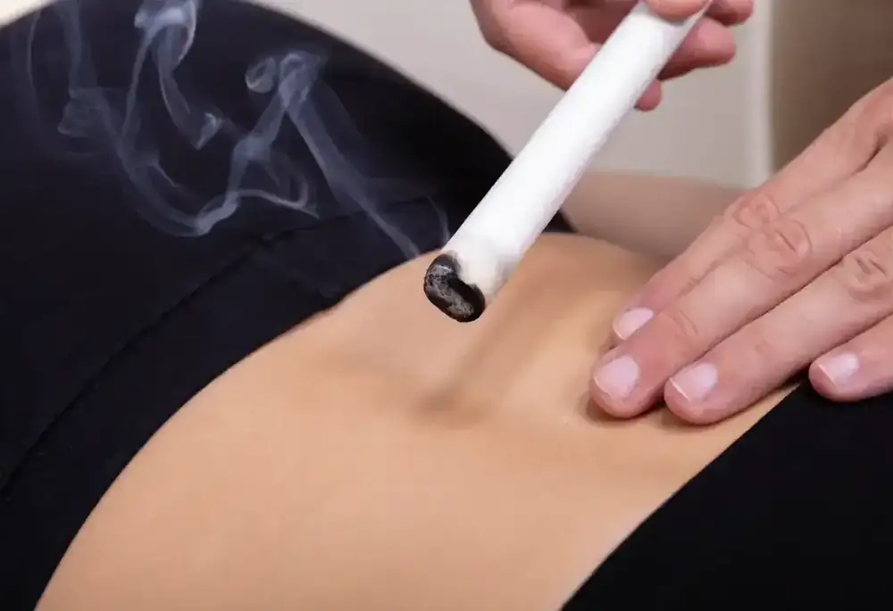 A lit moxa stick held above the lower abdomen, with smoke rising during treatment.