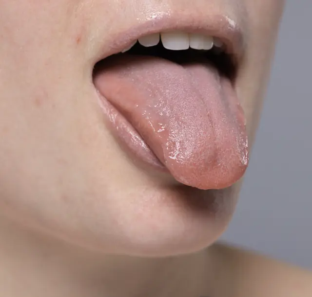 Example photo: the side of a tongue, stuck out at an angle.