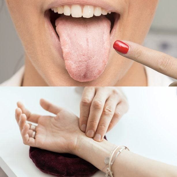 Tongue and pulse diagnosis: a woman shows her tongue while a practitioner’s fingers feel the pulse at her wrist.