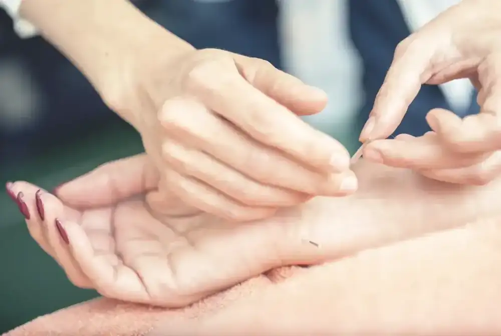 A practitioner gently placing a fine acupuncture needle at the wrist of a woman lying on a treatment couch.